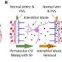 Brain waste clearance may relieve sickle cell disease pain