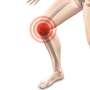 Nearly one billion people could live with osteoarthritis by 2050, international experts warn