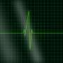 ECG-based AI algorithm could improve detection and prediction of heart diseases