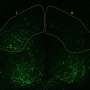 Increasing protective protein suppresses Parkinson's-linked buildup, more than doubling lifespan in mouse model