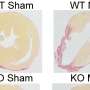 Enzyme inhibitor limits scarring after heart attacks and protects heart function in mice