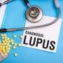 Lupus patients can lower their heart disease risk by sticking to one common treatment, study says