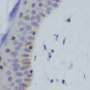 DNA sequencing test finds answers for patients with inherited muscle disease