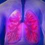 Common airway bacterium may help prepare lungs to fight pneumonia
