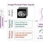 AI assistant learns from radiology reports to spot problems in abdominal scans
