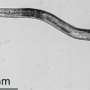 A tiny worm helps scientists unravel a genetic clue to kidney disease
