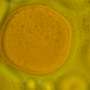 Rogue lipids: How routine cellular stress can fuel chronic inflammation