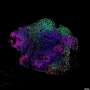 Stem cell-derived brain models offer a new window into how anesthesia works