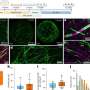 'Mini-brains' model myelin damage and regeneration, offering new tool for MS drug testing
