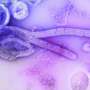 Kenya reports first-ever Ebola death
