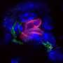Inflammation can reactivate 'sleeping' cancer cells hidden in the bone