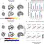 Ketamine relieves pain without 'disconnecting' consciousness, study finds