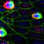 Airway lining fights infection by physically removing infected cells, experiments show