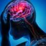 Anti-epileptic drug may reduce migraine aura