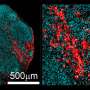 Year-old brain organoids reveal astrocytes may fuel early-onset epilepsy