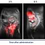 New polymer could enable gastrointestinal transit monitoring without ionizing radiation