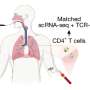 'Immune fog' may flag lung cancer risk years before tumor develops