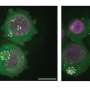 Trapping cancer-driving DNA rings outside cell nucleus silences their genes, researchers find