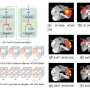 New method makes AI brain-disorder screening more transparent and computationally efficient
