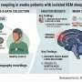 Brain responses to heartbeat are altered in patients with iRBD