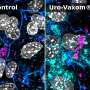 Hidden E. coli survive in bladder cells, but existing drug helps antibiotics reach them in lab tests