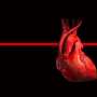 Digital alerts support timely treatment decisions of critically ill cardiac patients