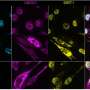 Protein LMOD1 offers new clues to muscle regeneration