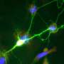 How a specific protein may drive brain damage in neuroHIV