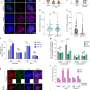 Cancer's 'rogue DNA' relies on two proteins to prevent and repair breaks