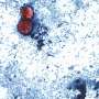Cyclospora found at Mexican farmed linked to lettuce outbreak, FDA says