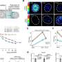 How RNA molecules influence the development of aggressive leukemia