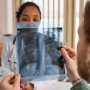 Pope Leo XIV's lung cancer highlights growing number of nonsmokers diagnosed with the disease—and younger people too