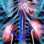 Almost 1 in 3 adults develop cardiorenal disease or die within 5 years of type 2 diabetes diagnosis