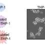 Immune cells reveal widespread SMN protein loss in spinal muscular atrophy