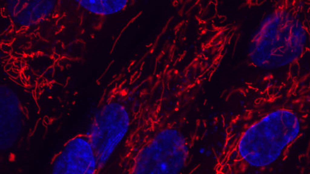 STAT+: Kyverna’s cell therapy shows lasting autoimmune benefit