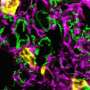 How blood vessels distinguish between growth and inflammation