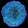 How the APOE4 gene damages brain blood vessels in Alzheimer's disease