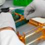 Fat-storing gene emerges as possible contributor to anorexia risk