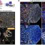Immune cells that may help sustain type 1 diabetes attack identified