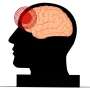 Traumatic brain injury can alter the brain's subsequent response to stress, study shows
