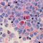 Common leukemia mutation derails protein positioning during cell division, study reveals