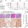 One dose of protein-targeting CAR-T cells shrinks solid tumors in preclinical tests