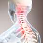 Myeloma risk modestly increased in adults with an incidentally detected vertebral fracture