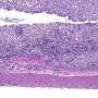 Protein reins in intestinal inflammation by curbing an overactive immune signal