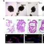 Human lung organoids with a built-in immune system could transform respiratory disease research