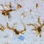Brain immune cells protect neurons in Parkinson's disease by 'nibbling' harmful material