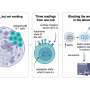 Investigators identify a metabolic weak point in exhausted immune cells in head and neck cancer