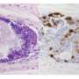 First successful primate transplant of human pituitary tissue boosts cortisol levels