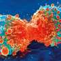 An epigenetic blueprint reveals how aggressive MYC amplification fuels cancer