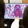 Targeting two proteins to prevent pulmonary hypertension